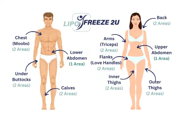 Areas you can have fat freezing treatment Gainsborough