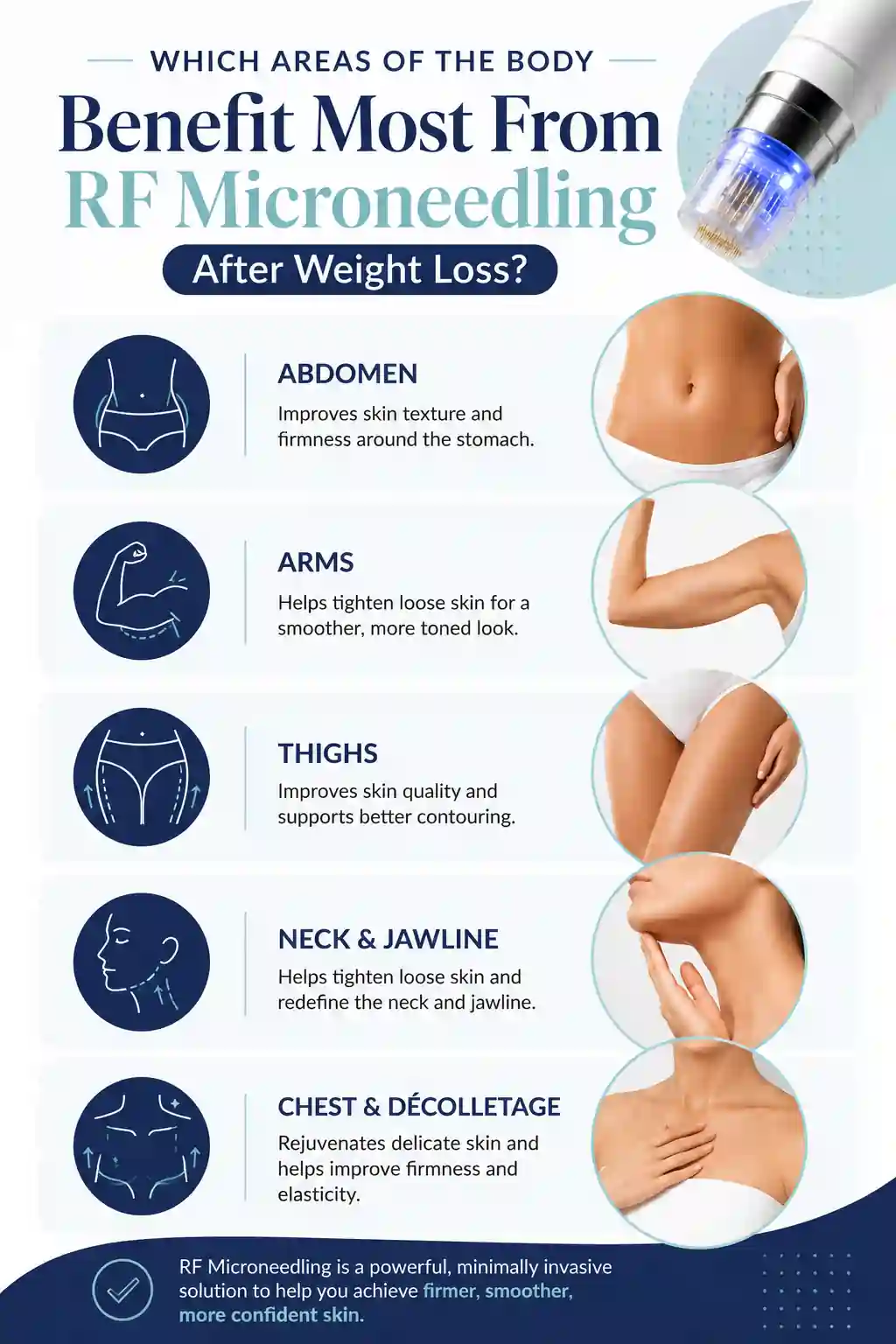 Which Areas of the Body Benefit Most From RF Microneedling After Weight Loss Gainsborough